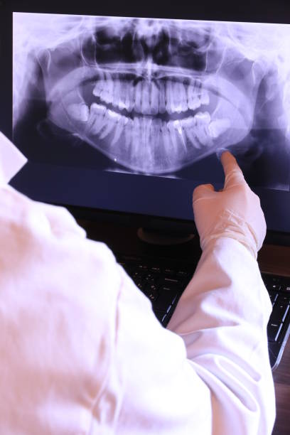 Best Tooth Infection Emergency Dentist  in Rockdale, TX